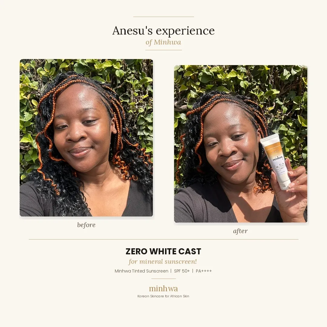 Anesu before and after using Minhwa tinted sunscreen